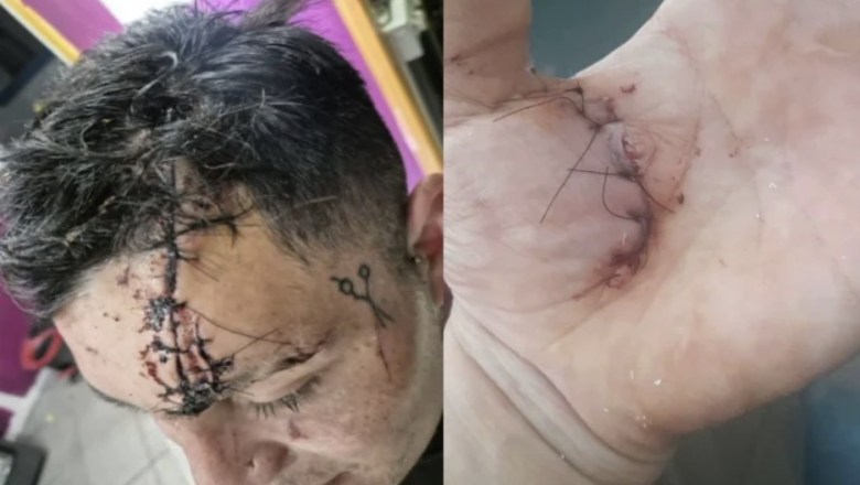 Ushuaia: investigan brutal ataque a un joven que despertó herido tras perder el conocimiento