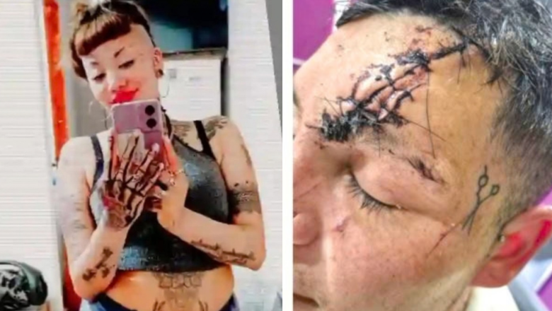 Ofreció $10 millones por desfigurarle la cara: la víctima aceptó y la agresora quedó libre