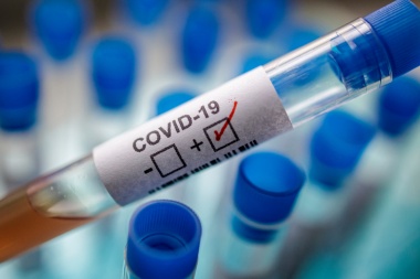 CORONAVIRUS: Se registraron 2 nuevos casos en Ushuaia y la provincia llega a 83 casos