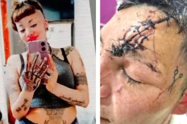 Ofreció $10 millones por desfigurarle la cara: la víctima aceptó y la agresora quedó libre