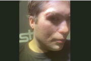 Chofer de UBER agredido por pasajeros en Río Grande